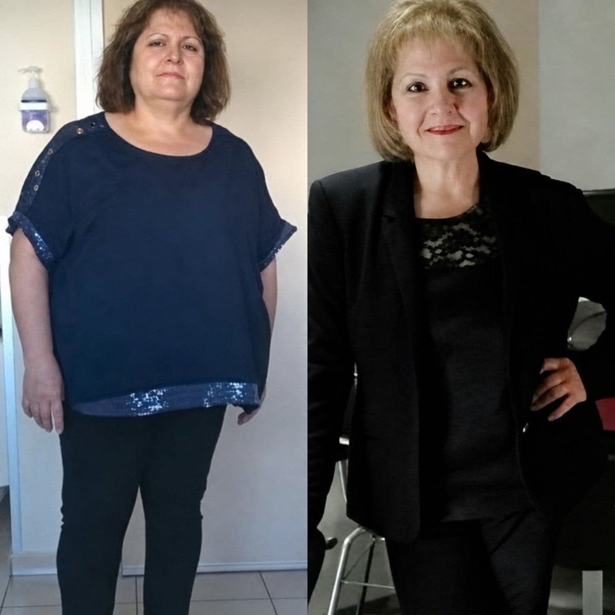 gastric band