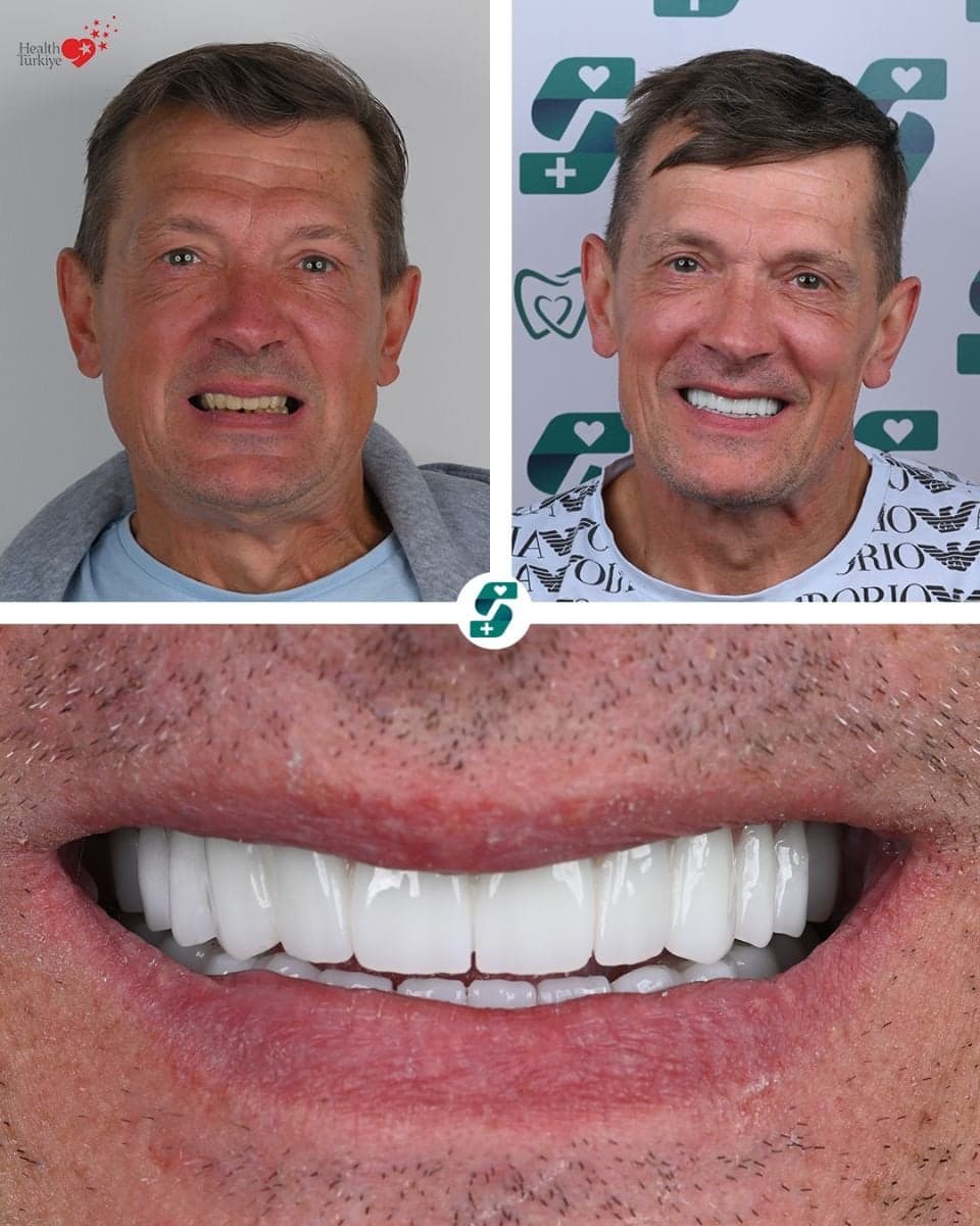 dental treatment with sedation