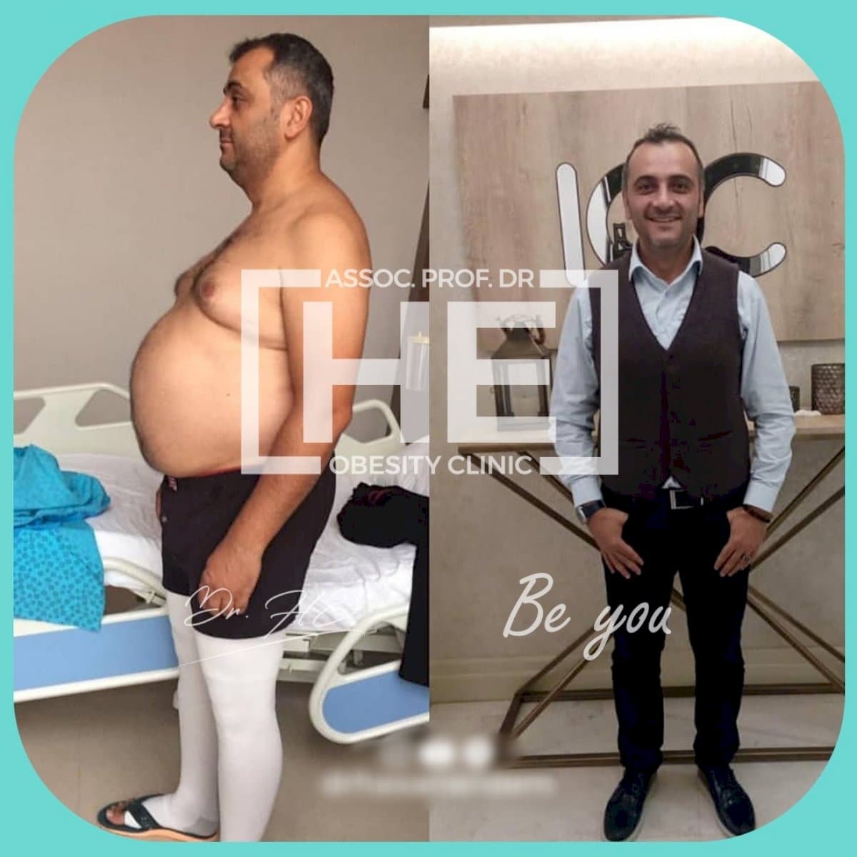 gastric band