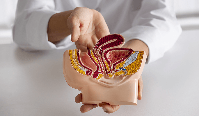 Colon Cancer