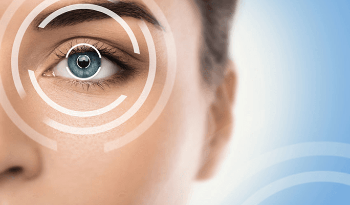 Astigmatism