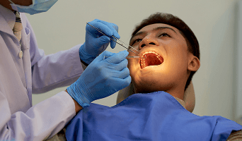 Apex Resection