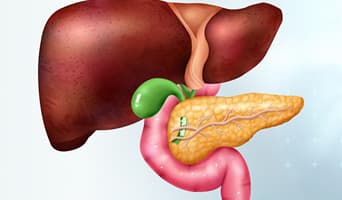 Cholangiocarcinoma Treatment