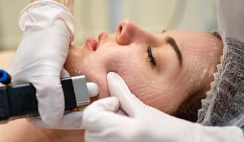 Facial Feminization Surgery (FFS)