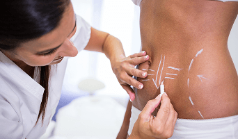 Fat Grafting / Fat Transfer