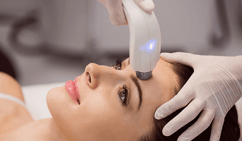 Fraxel Laser Treatment