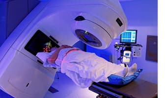 IMRT Radiation Therapy