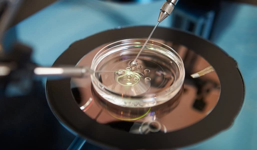 IVF with Donor Eggs