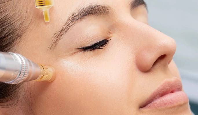PRP Skin Treatment