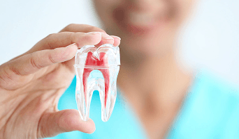 Root Canal (per tooth)