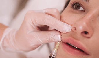 Sculptra (Injectable Collagen Stimulator)