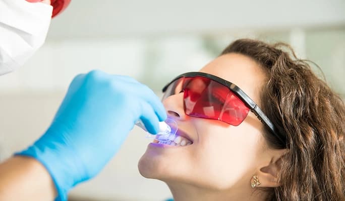 Teeth Whitening