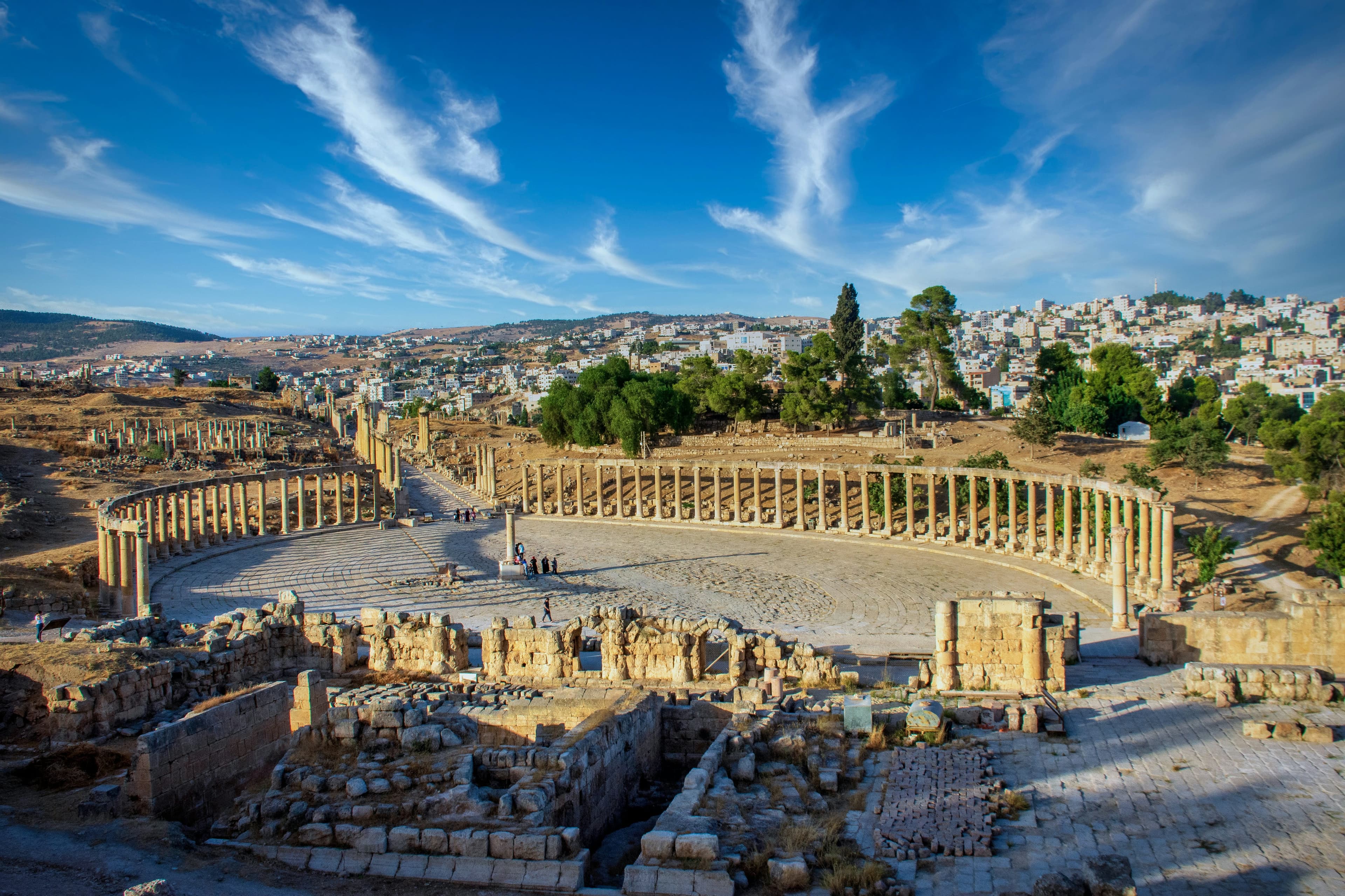 Kidney Transplant in Jordan