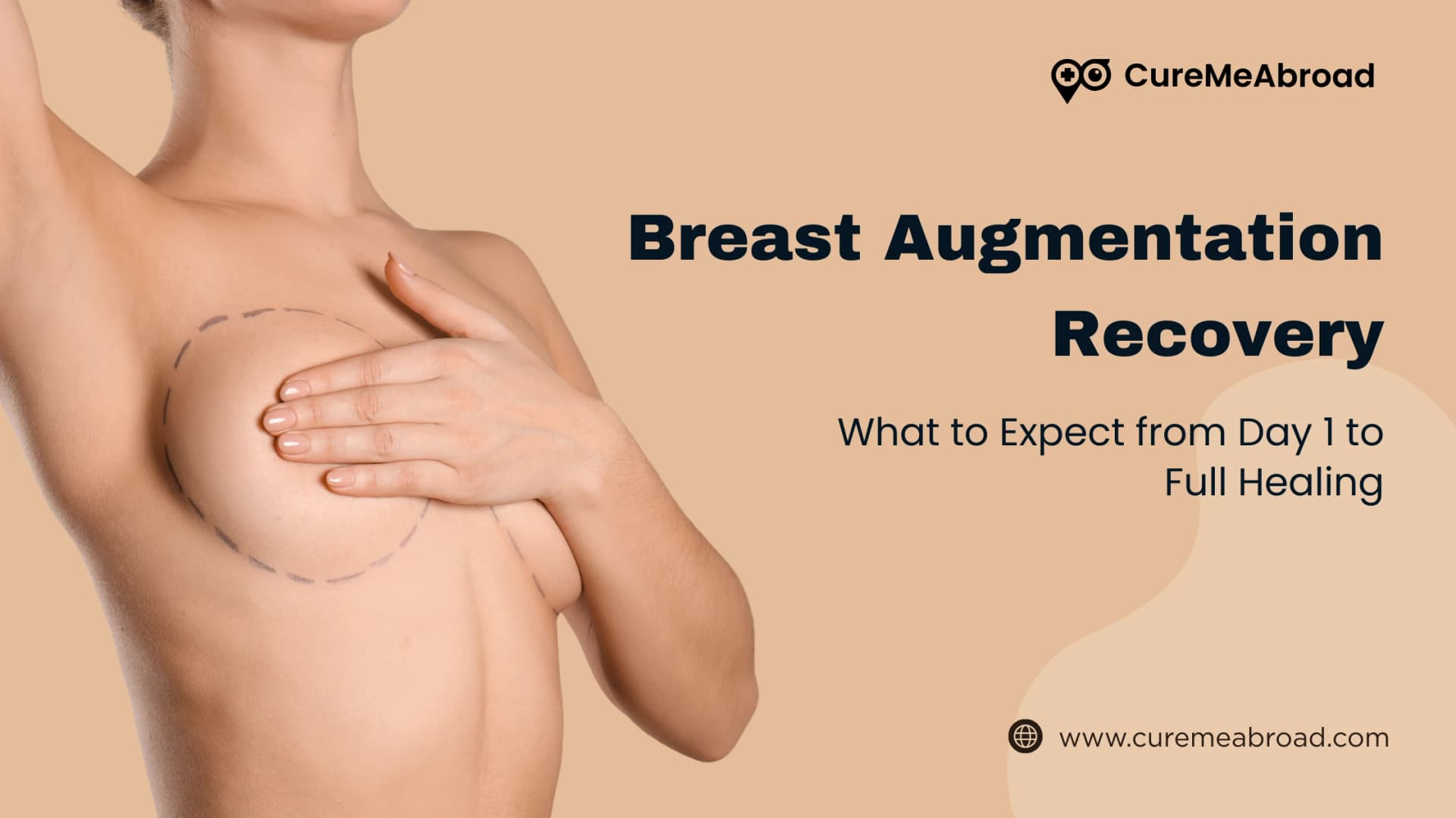 Breast Augmentation Recovery: What to Expect from Day 1 to Full Healing