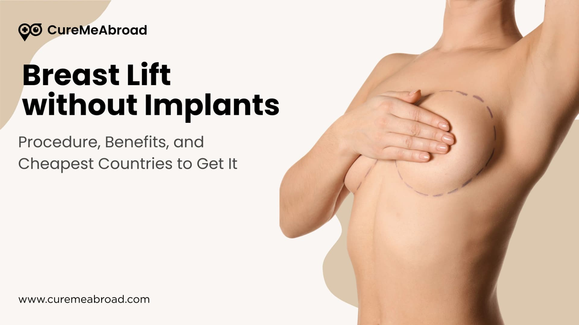 Breast Lift without Implants: Procedure, Benefits, and Cheapest Countries to Get It