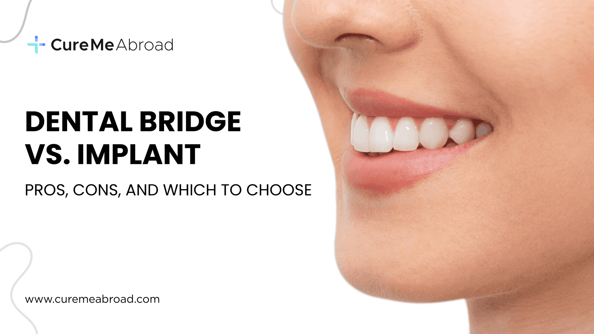 Dental Bridge vs. Implant: Pros, Cons, and Which to Choose