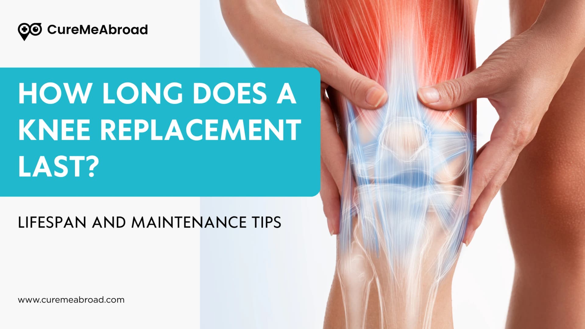 How Long Does a Knee Replacement Last? Lifespan and Maintenance Tips
