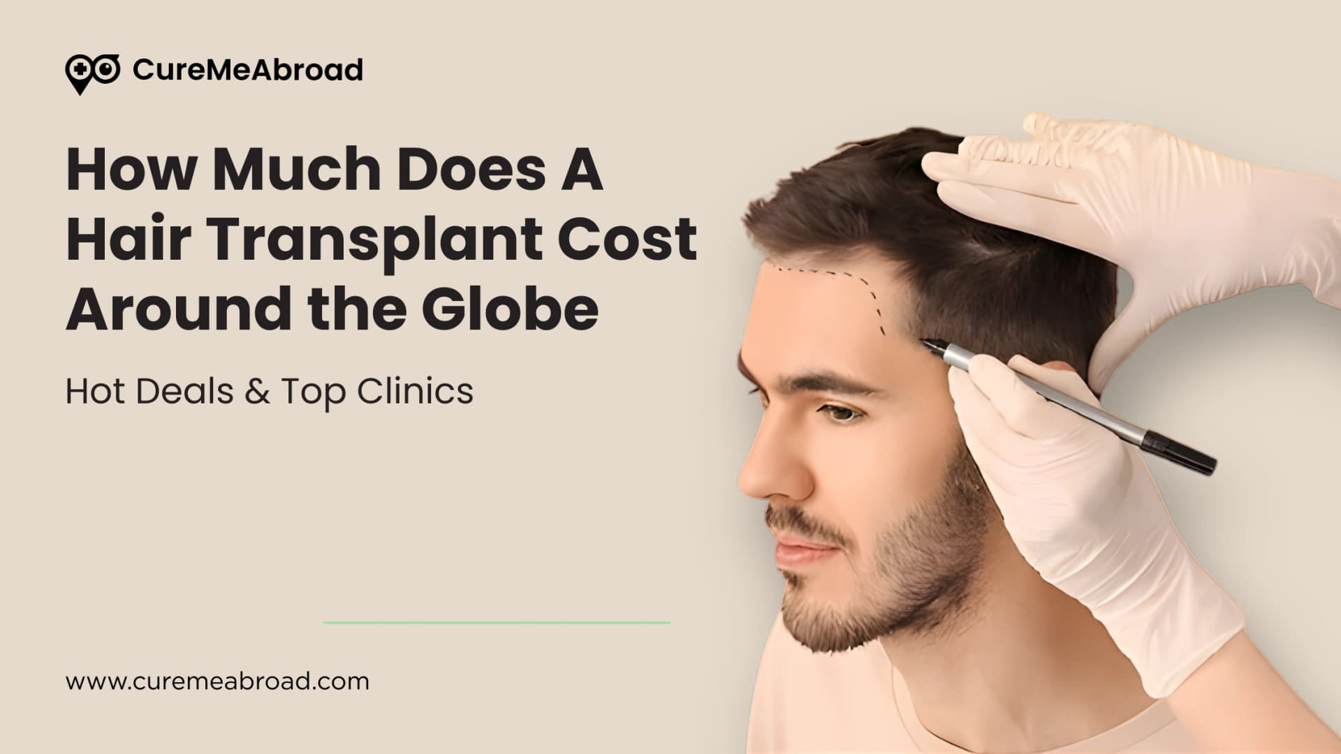 How Much Does A Hair Transplant Cost Around the Globe: Hot Deals & Top Clinics