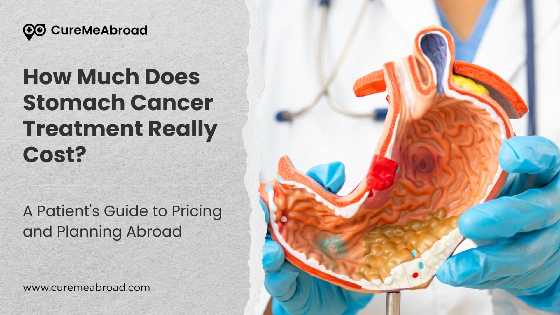 How Much Does Stomach Cancer Treatment Really Cost? A Patient's Guide to Pricing and Planning Abroad