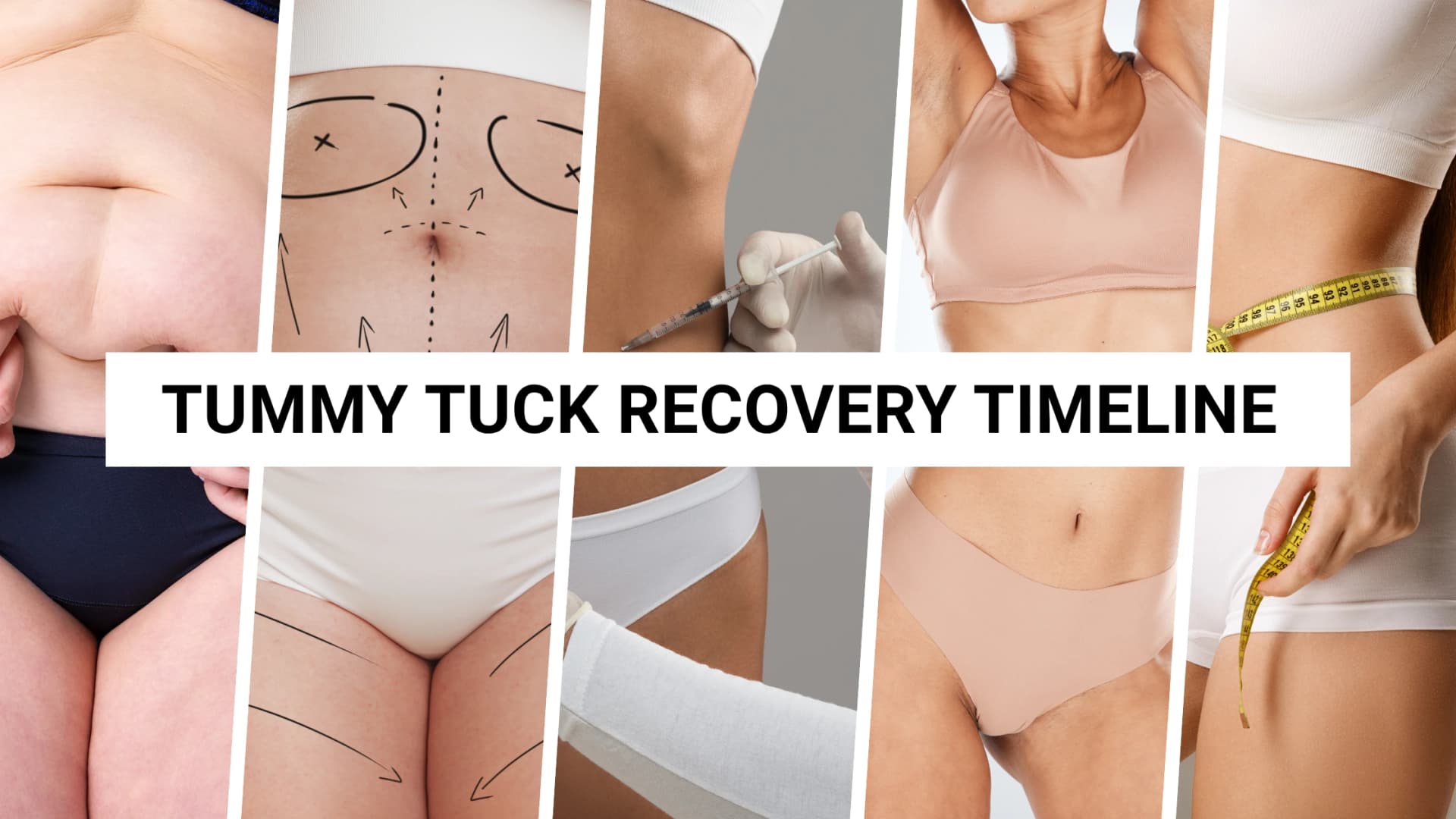 TUMMY TUCK RECOVERY TIMELINE