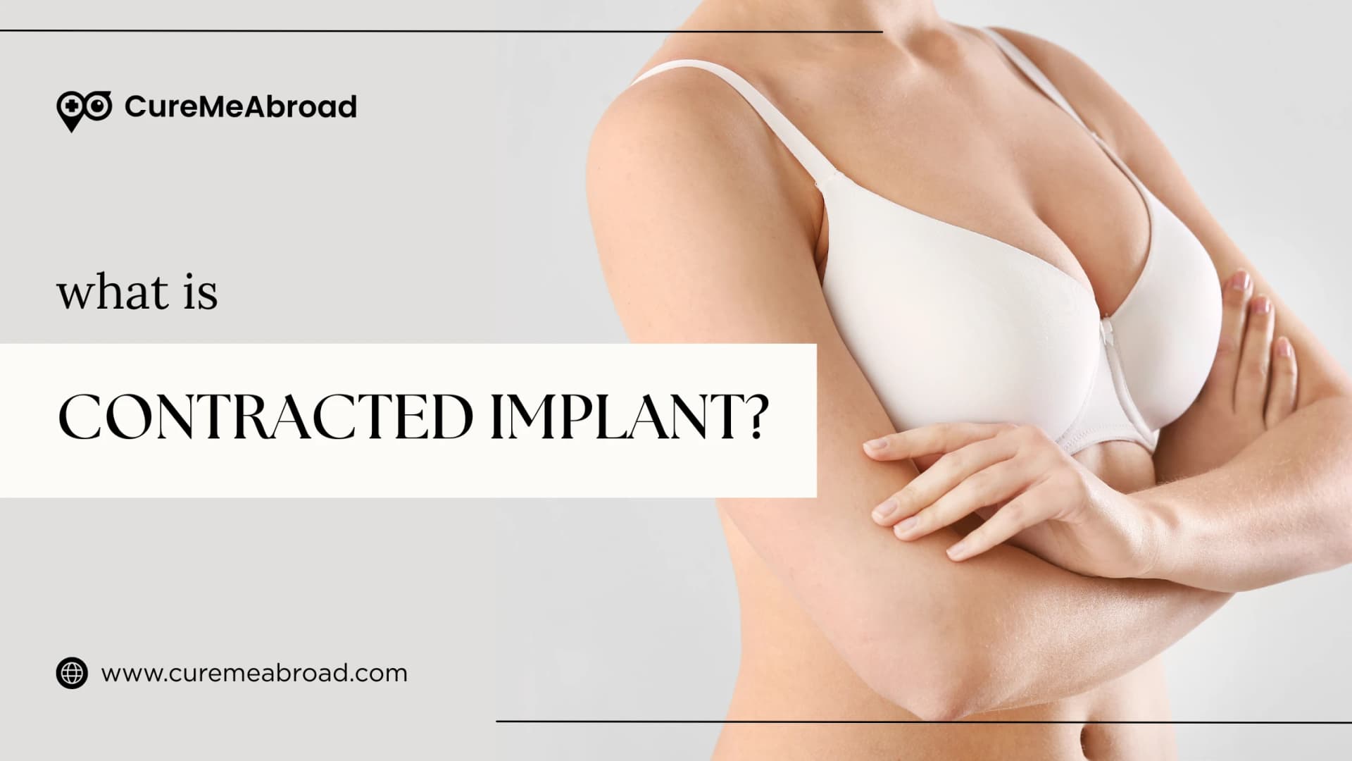 WHAT IS CONTRACTED IMPLANT?